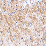 Immunohistochemistry - Anti-HSPB7 Antibody (A307784) - Antibodies.com