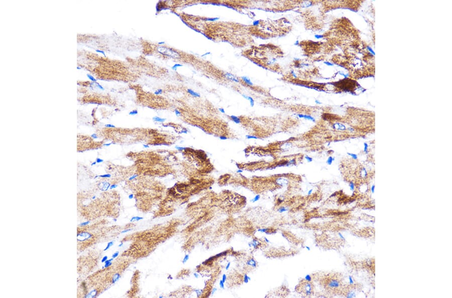 Immunohistochemistry - Anti-HSPB7 Antibody (A307784) - Antibodies.com
