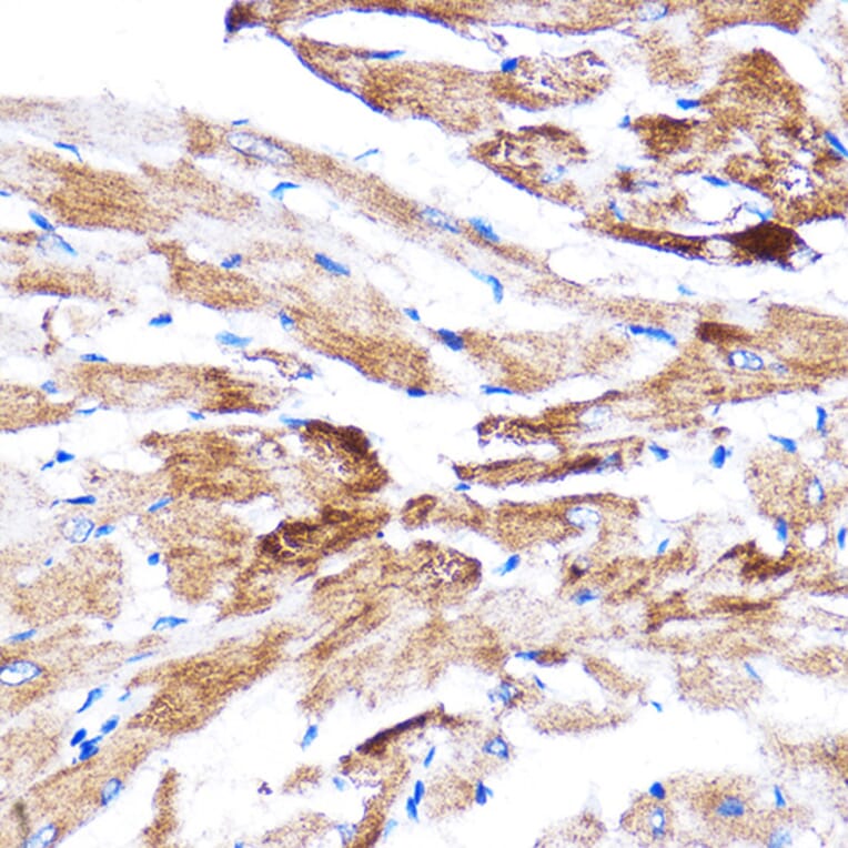 Immunohistochemistry - Anti-HSPB7 Antibody (A307784) - Antibodies.com