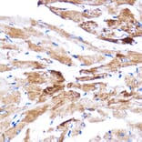 Immunohistochemistry - Anti-HSPB7 Antibody (A307784) - Antibodies.com