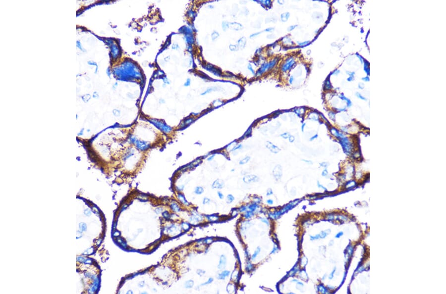 Immunohistochemistry - Anti-HSPB7 Antibody (A307784) - Antibodies.com