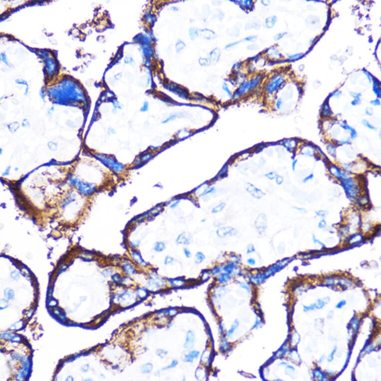 Immunohistochemistry - Anti-HSPB7 Antibody (A307784) - Antibodies.com