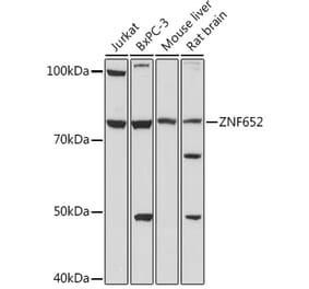 Western Blot - Anti-ZNF652 Antibody (A307785) - Antibodies.com