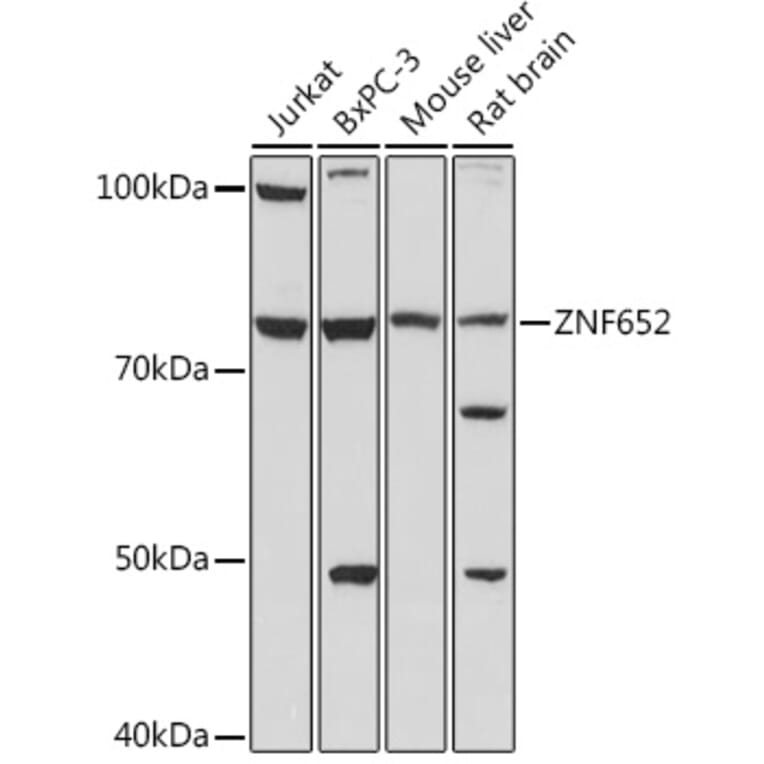 Western Blot - Anti-ZNF652 Antibody (A307785) - Antibodies.com