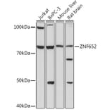 Western Blot - Anti-ZNF652 Antibody (A307785) - Antibodies.com