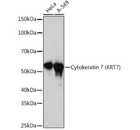 Western Blot - Anti-Cytokeratin 7 Antibody [ARC1267] (A307787) - Antibodies.com