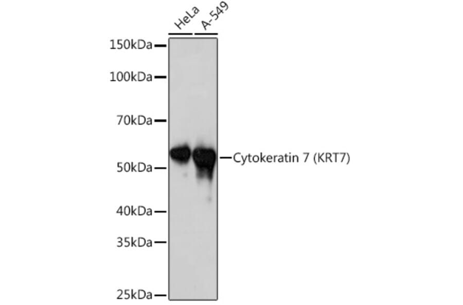 Western Blot - Anti-Cytokeratin 7 Antibody [ARC1267] (A307787) - Antibodies.com