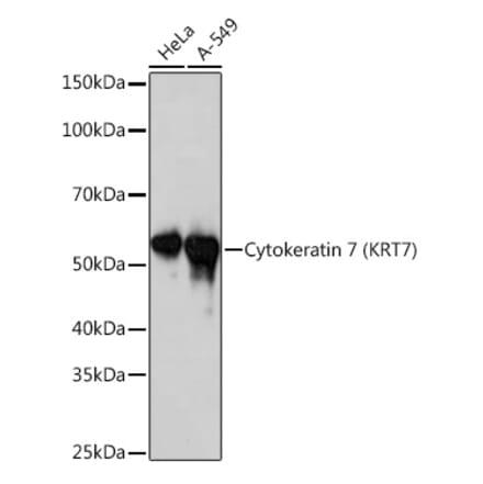 Western Blot - Anti-Cytokeratin 7 Antibody [ARC1267] (A307787) - Antibodies.com