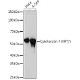 Western Blot - Anti-Cytokeratin 7 Antibody [ARC1267] (A307787) - Antibodies.com