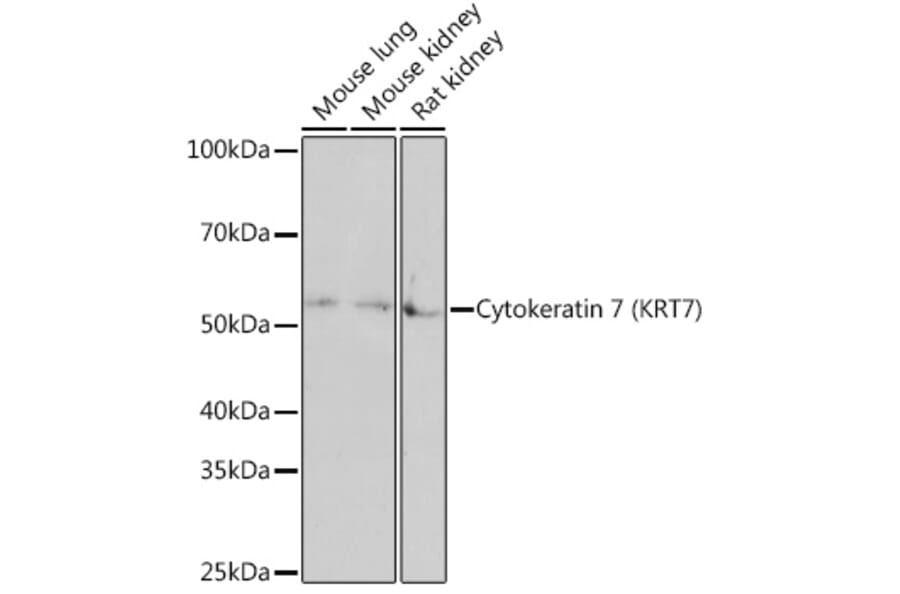 Western Blot - Anti-Cytokeratin 7 Antibody [ARC1267] (A307787) - Antibodies.com