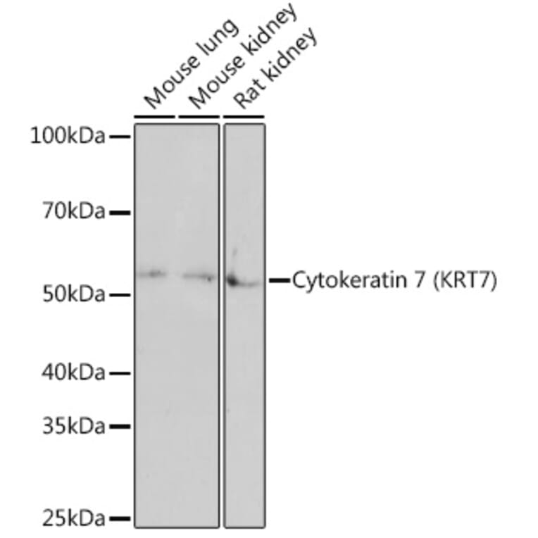 Western Blot - Anti-Cytokeratin 7 Antibody [ARC1267] (A307787) - Antibodies.com