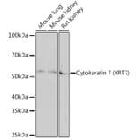 Western Blot - Anti-Cytokeratin 7 Antibody [ARC1267] (A307787) - Antibodies.com