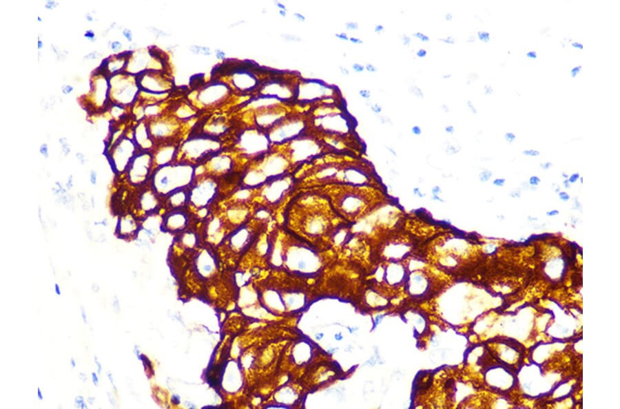 Immunohistochemistry - Anti-Cytokeratin 7 Antibody [ARC1267] (A307787) - Antibodies.com
