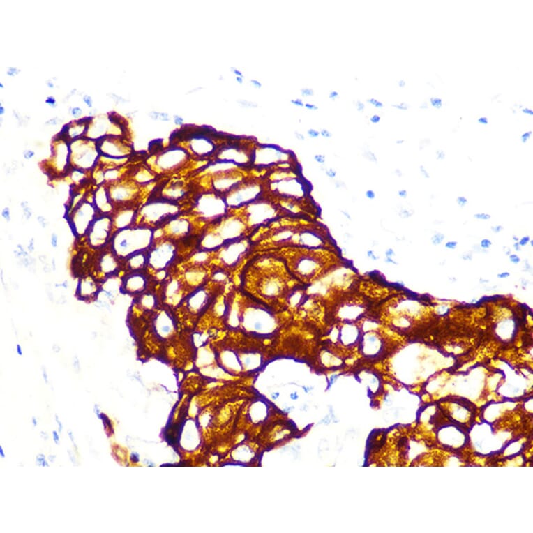 Immunohistochemistry - Anti-Cytokeratin 7 Antibody [ARC1267] (A307787) - Antibodies.com