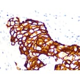 Immunohistochemistry - Anti-Cytokeratin 7 Antibody [ARC1267] (A307787) - Antibodies.com