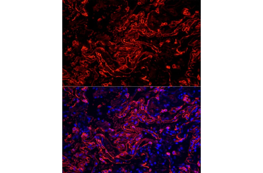 Immunofluorescence - Anti-Cytokeratin 7 Antibody [ARC1267] (A307787) - Antibodies.com