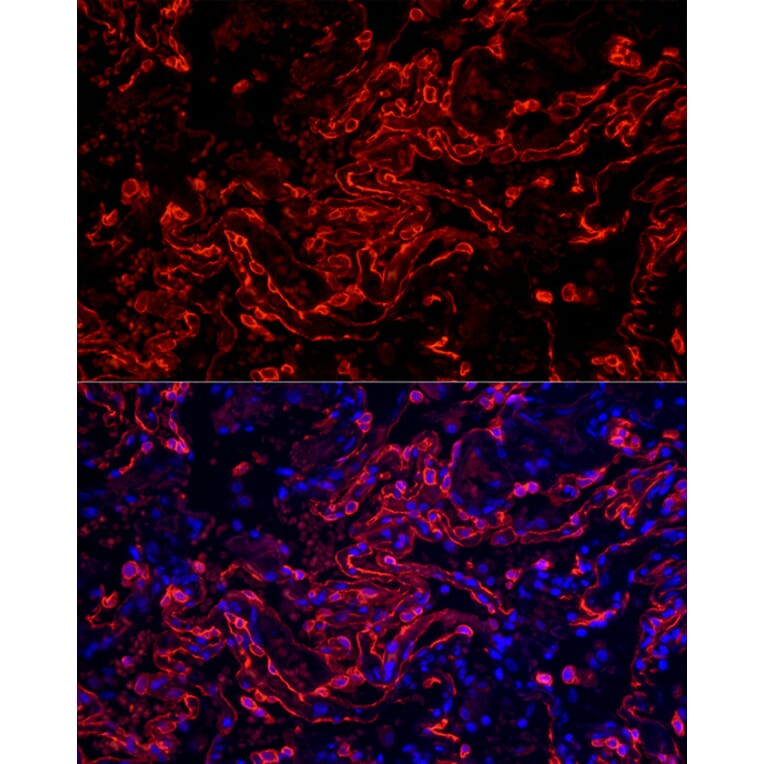 Immunofluorescence - Anti-Cytokeratin 7 Antibody [ARC1267] (A307787) - Antibodies.com