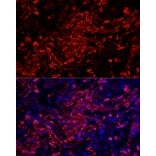 Immunofluorescence - Anti-Cytokeratin 7 Antibody [ARC1267] (A307787) - Antibodies.com