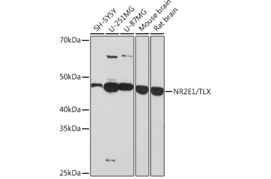 Western Blot - Anti-NR2E1/Tailless/TLX Antibody [ARC1295] (A307791) - Antibodies.com