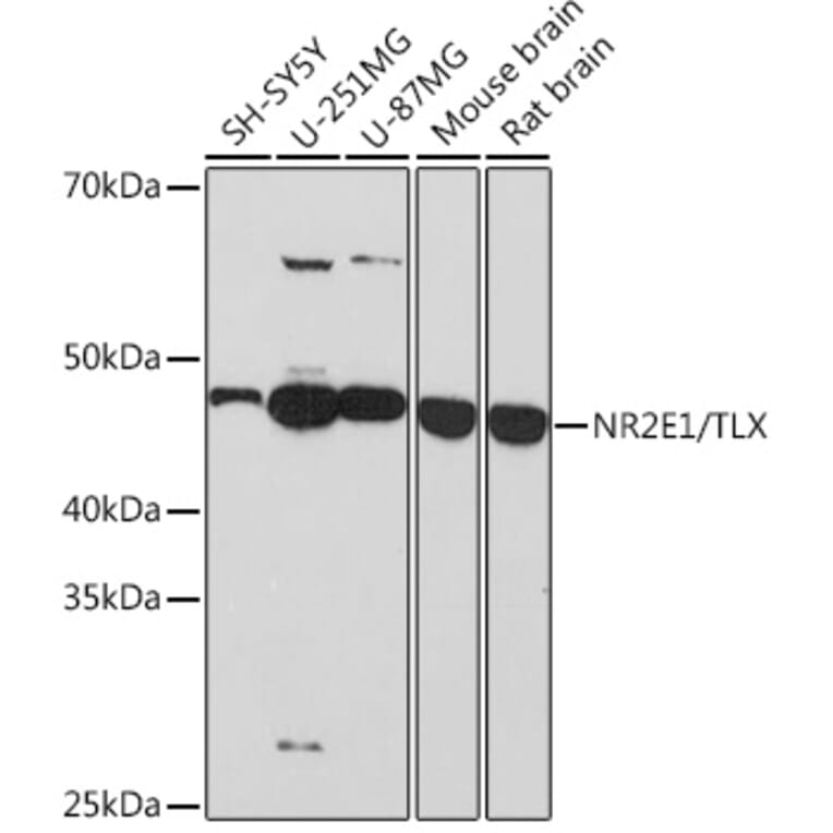 Western Blot - Anti-NR2E1/Tailless/TLX Antibody [ARC1295] (A307791) - Antibodies.com