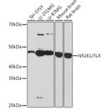 Western Blot - Anti-NR2E1/Tailless/TLX Antibody [ARC1295] (A307791) - Antibodies.com