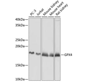 Western Blot - Anti-Glutathione Peroxidase 4 Antibody [ARC0558] (A307793) - Antibodies.com
