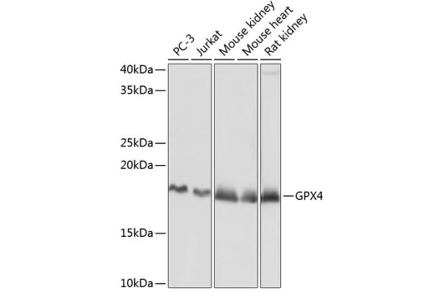 Western Blot - Anti-Glutathione Peroxidase 4 Antibody [ARC0558] (A307793) - Antibodies.com