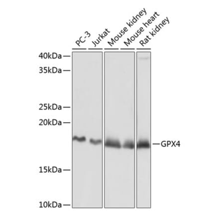 Western Blot - Anti-Glutathione Peroxidase 4 Antibody [ARC0558] (A307793) - Antibodies.com