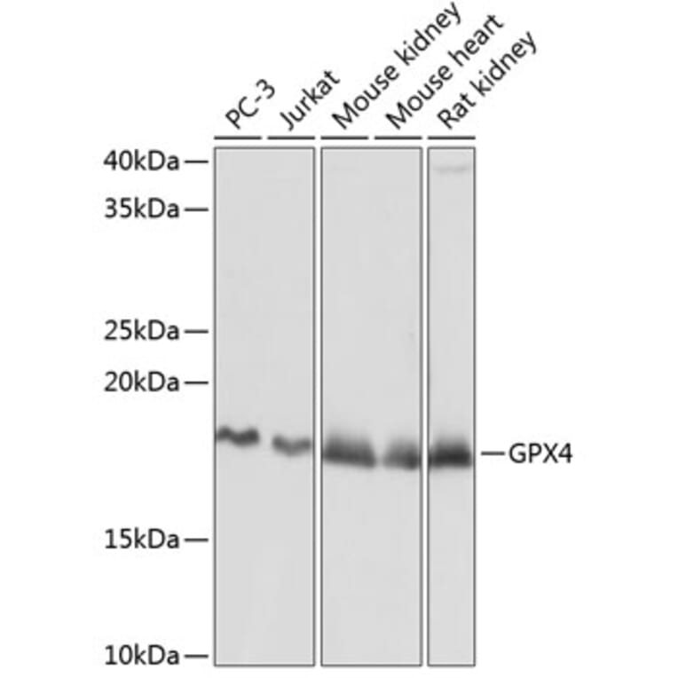 Western Blot - Anti-Glutathione Peroxidase 4 Antibody [ARC0558] (A307793) - Antibodies.com