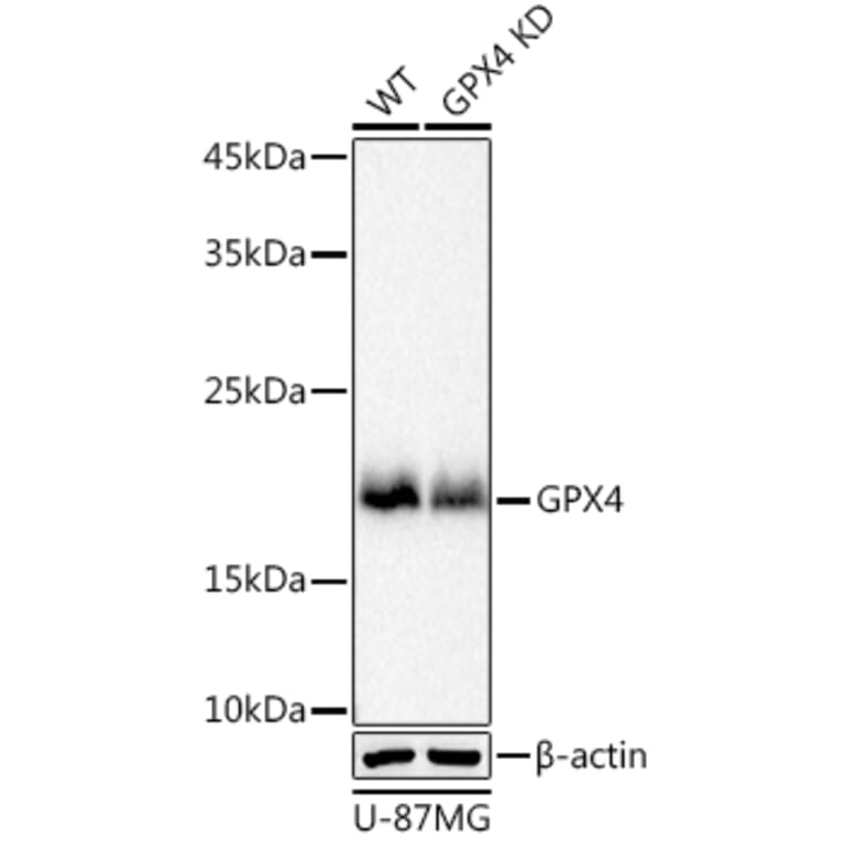 Western Blot - Anti-Glutathione Peroxidase 4 Antibody [ARC0558] (A307793) - Antibodies.com