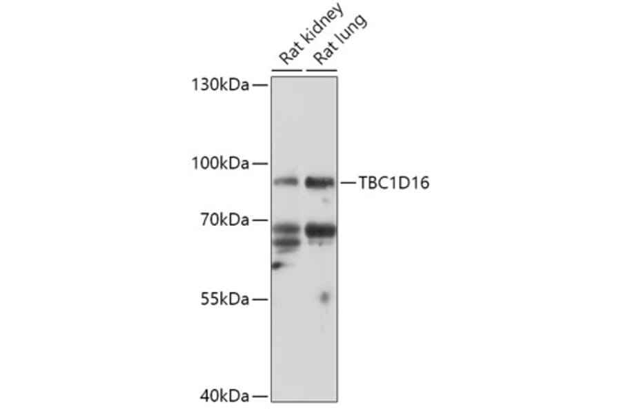 Western Blot - Anti-TBC1D16 Antibody (A307794) - Antibodies.com