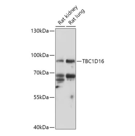 Western Blot - Anti-TBC1D16 Antibody (A307794) - Antibodies.com
