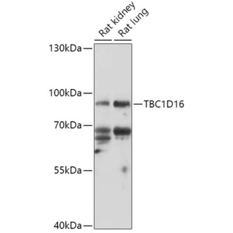Western Blot - Anti-TBC1D16 Antibody (A307794) - Antibodies.com