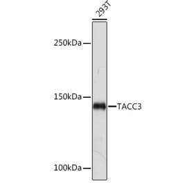 Western Blot - Anti-TACC3 Antibody [ARC2195] (A307799) - Antibodies.com