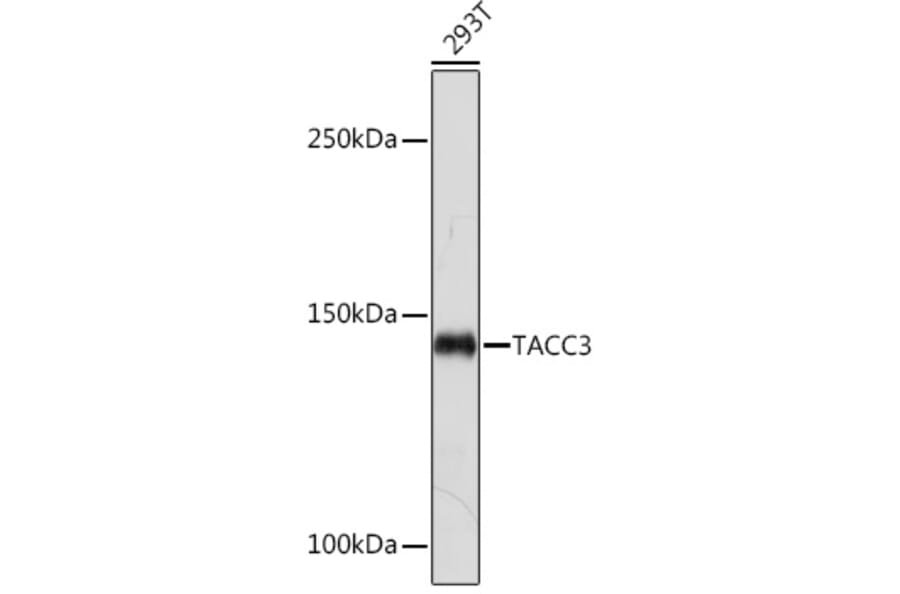 Western Blot - Anti-TACC3 Antibody [ARC2195] (A307799) - Antibodies.com