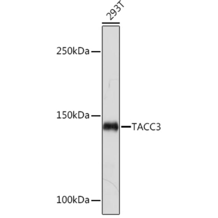 Western Blot - Anti-TACC3 Antibody [ARC2195] (A307799) - Antibodies.com