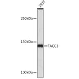 Western Blot - Anti-TACC3 Antibody [ARC2195] (A307799) - Antibodies.com