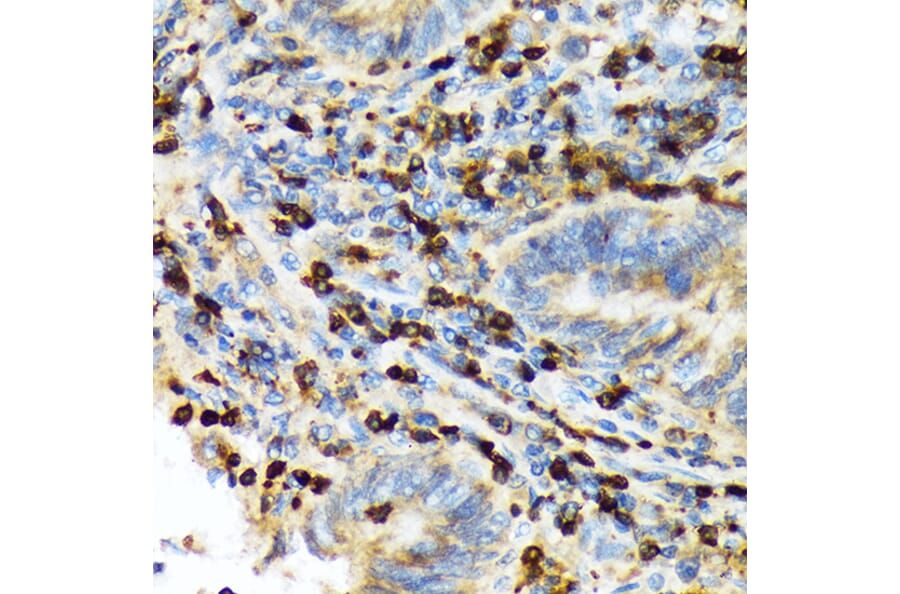 Immunohistochemistry - Anti-TACC3 Antibody [ARC2195] (A307799) - Antibodies.com