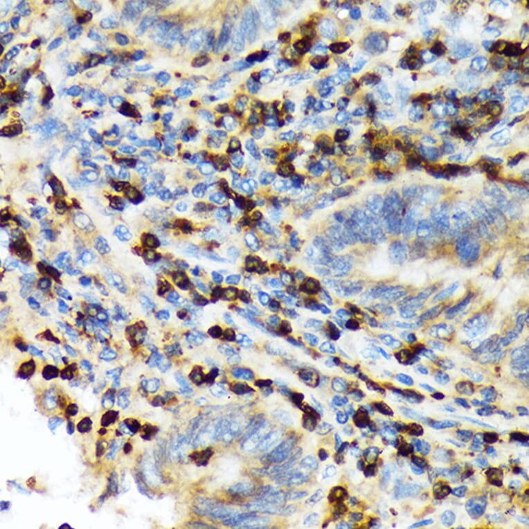 Immunohistochemistry - Anti-TACC3 Antibody [ARC2195] (A307799) - Antibodies.com