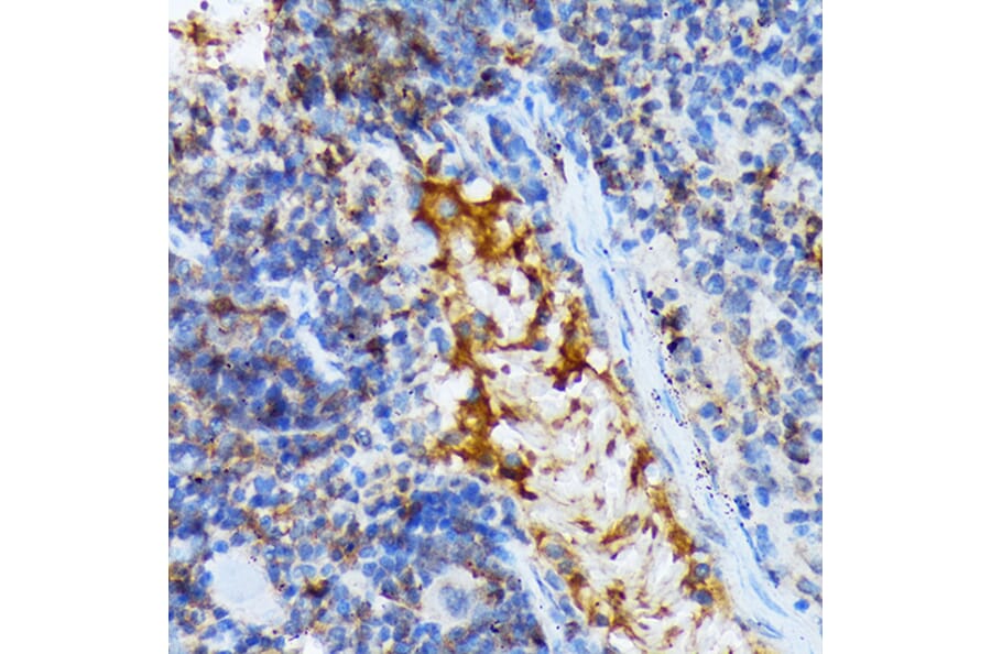 Immunohistochemistry - Anti-TACC3 Antibody [ARC2195] (A307799) - Antibodies.com