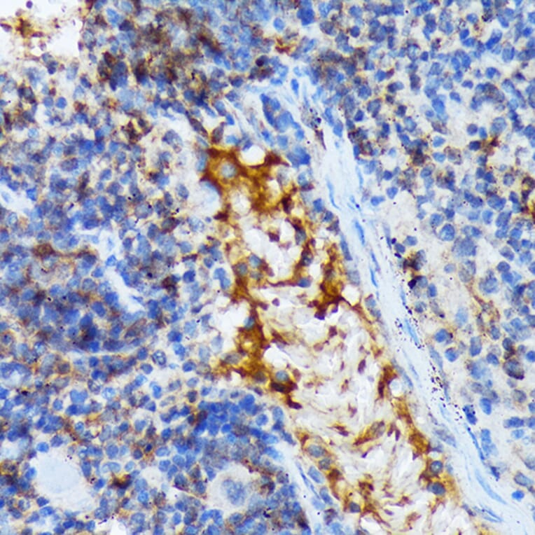 Immunohistochemistry - Anti-TACC3 Antibody [ARC2195] (A307799) - Antibodies.com