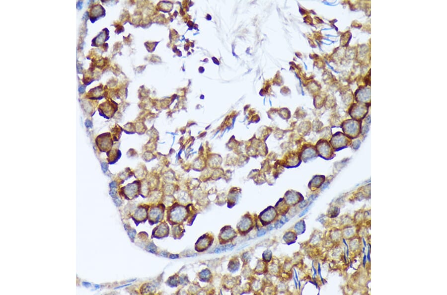 Immunohistochemistry - Anti-TACC3 Antibody [ARC2195] (A307799) - Antibodies.com