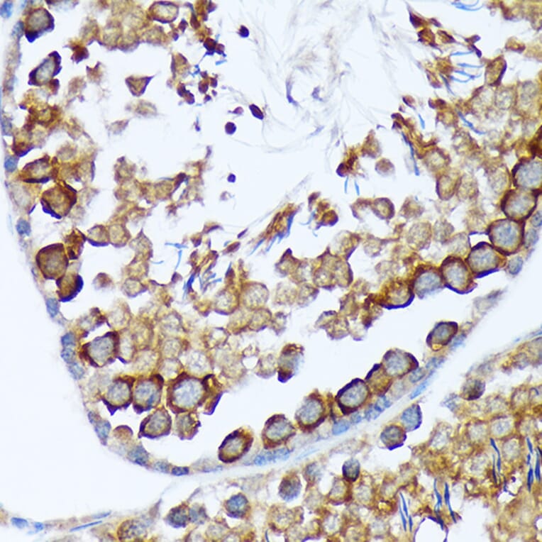 Immunohistochemistry - Anti-TACC3 Antibody [ARC2195] (A307799) - Antibodies.com