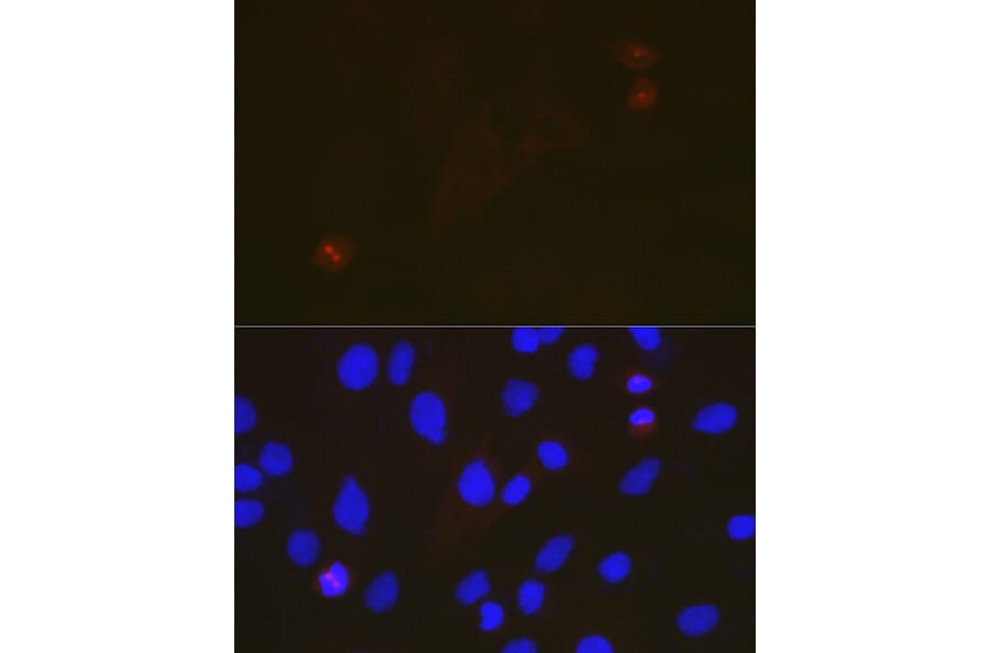 Immunofluorescence - Anti-TACC3 Antibody [ARC2195] (A307799) - Antibodies.com