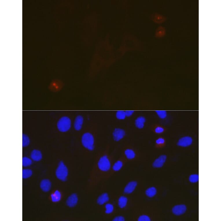 Immunofluorescence - Anti-TACC3 Antibody [ARC2195] (A307799) - Antibodies.com