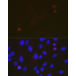 Immunofluorescence - Anti-TACC3 Antibody [ARC2195] (A307799) - Antibodies.com