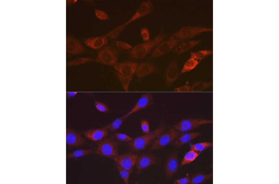 Immunofluorescence - Anti-TACC3 Antibody [ARC2195] (A307799) - Antibodies.com