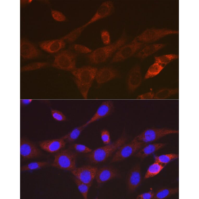 Immunofluorescence - Anti-TACC3 Antibody [ARC2195] (A307799) - Antibodies.com