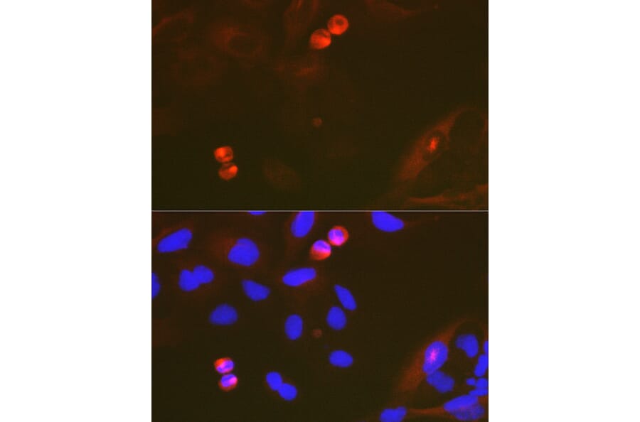Immunofluorescence - Anti-TACC3 Antibody [ARC2195] (A307799) - Antibodies.com