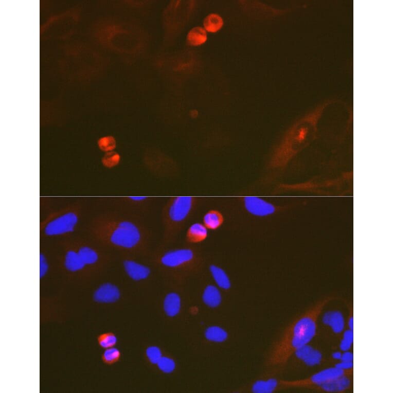 Immunofluorescence - Anti-TACC3 Antibody [ARC2195] (A307799) - Antibodies.com